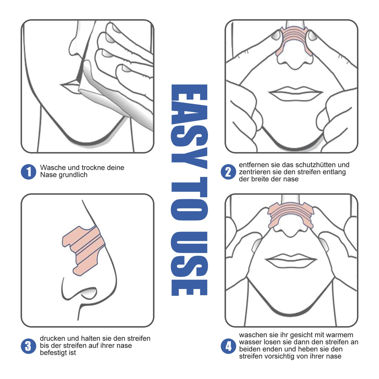 Nasal Ventilator Nasal Strip